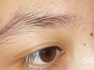 瞳孔之谜（瞳孔颜色的多样性与其隐藏的健康暗示）