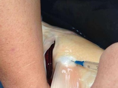 锦鲤鱼鳍裂愈合时间的探究（科学解读锦鲤鱼鳍裂愈合过程中的时间因素）