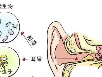 如何正确清理哈士奇的耳道和耳垢（宠物养护知识之一）