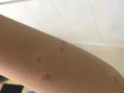 狗狗生病的常见症状及如何应对（了解狗狗常见疾病的症状，保护它们的健康）