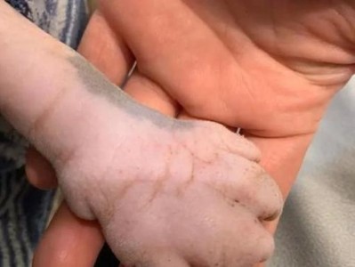 小猫爪子烂了，该如何治疗？（了解小猫爪子烂的原因及治疗方法，保护它们的健康。）
