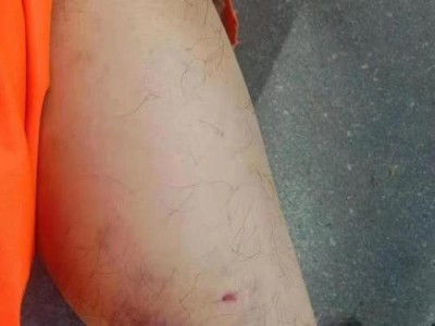 狗狗为何会咬我的腿？（探究狗狗咬腿的原因及如何应对）